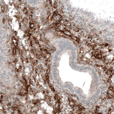 Immunohistochemistry (Formalin/PFA-fixed paraffin-embedded sections) - Anti-ITGA8 antibody [CL7304] (AB243027)