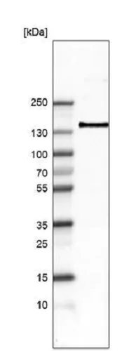Western blot - Anti-ITGA8 antibody [CL7304] (AB243027)