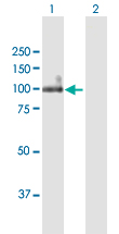 Western blot - Anti-ITGB6 antibody (AB169271)