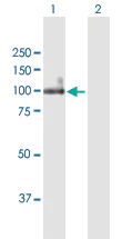 Western blot - Anti-ITGB6 antibody (AB169271)