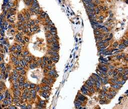 Immunohistochemistry (Formalin/PFA-fixed paraffin-embedded sections) - Anti-ITGB6 antibody (AB197672)