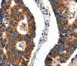 Immunohistochemistry (Formalin/PFA-fixed paraffin-embedded sections) - Anti-ITGB6 antibody (AB197672)