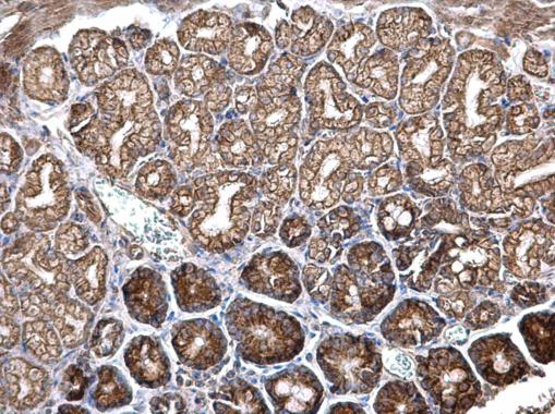 Immunohistochemistry (Formalin/PFA-fixed paraffin-embedded sections) - Anti-ITGB6 antibody (AB229552)