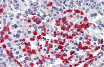 Immunohistochemistry (Formalin/PFA-fixed paraffin-embedded sections) - Anti-ITGB6 antibody (AB233519), expandable thumbnail