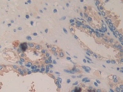 Immunohistochemistry (Formalin/PFA-fixed paraffin-embedded sections) - Anti-ITGB6 antibody (AB233519), expandable thumbnail