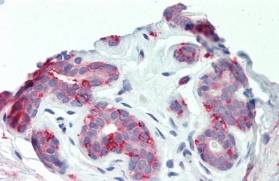 Immunohistochemistry (Formalin/PFA-fixed paraffin-embedded sections) - Anti-ITGB6 antibody (AB233519), expandable thumbnail