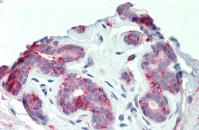 Immunohistochemistry (Formalin/PFA-fixed paraffin-embedded sections) - Anti-ITGB6 antibody (AB233519)