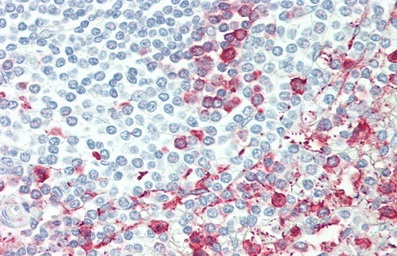 Immunohistochemistry (Formalin/PFA-fixed paraffin-embedded sections) - Anti-ITGB6 antibody (AB233519), expandable thumbnail