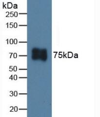 Western blot - Anti-ITGB6 antibody (AB233519), expandable thumbnail