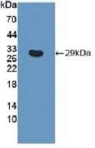 Western blot - Anti-ITGB6 antibody (ab233519), expandable thumbnail