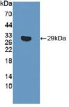 Western blot - Anti-ITGB6 antibody (AB233519)