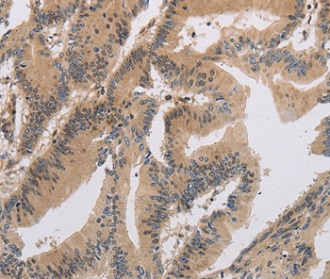 Immunohistochemistry (Formalin/PFA-fixed paraffin-embedded sections) - Anti-ITIH1/SHAP antibody (AB198809), expandable thumbnail
