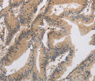 Immunohistochemistry (Formalin/PFA-fixed paraffin-embedded sections) - Anti-ITIH1/SHAP antibody (AB198809)