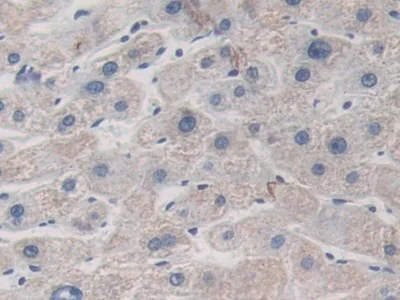 Immunohistochemistry (Formalin/PFA-fixed paraffin-embedded sections) - Anti-ITIH1/SHAP antibody (AB233032)