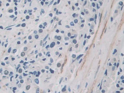 Immunohistochemistry (Formalin/PFA-fixed paraffin-embedded sections) - Anti-ITIH1/SHAP antibody (AB233032)