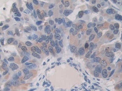 Immunohistochemistry (Formalin/PFA-fixed paraffin-embedded sections) - Anti-ITIH1/SHAP antibody (AB233032)