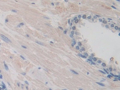 Immunohistochemistry (Formalin/PFA-fixed paraffin-embedded sections) - Anti-ITIH1/SHAP antibody (AB233032)