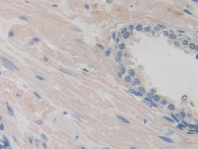 Immunohistochemistry (Formalin/PFA-fixed paraffin-embedded sections) - Anti-ITIH1/SHAP antibody (AB233032)