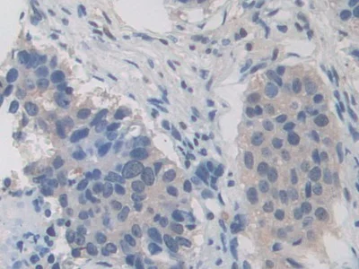 Immunohistochemistry (Formalin/PFA-fixed paraffin-embedded sections) - Anti-ITIH1/SHAP antibody (AB233032)
