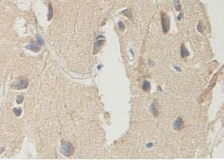 Immunohistochemistry (Formalin/PFA-fixed paraffin-embedded sections) - Anti-ITIH2/SHAP antibody (AB118257), expandable thumbnail