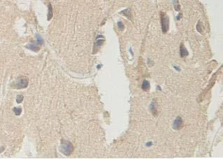 Immunohistochemistry (Formalin/PFA-fixed paraffin-embedded sections) - Anti-ITIH2/SHAP antibody (AB118257)