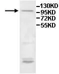 Western blot - Anti-ITIH2/SHAP antibody (AB118257)