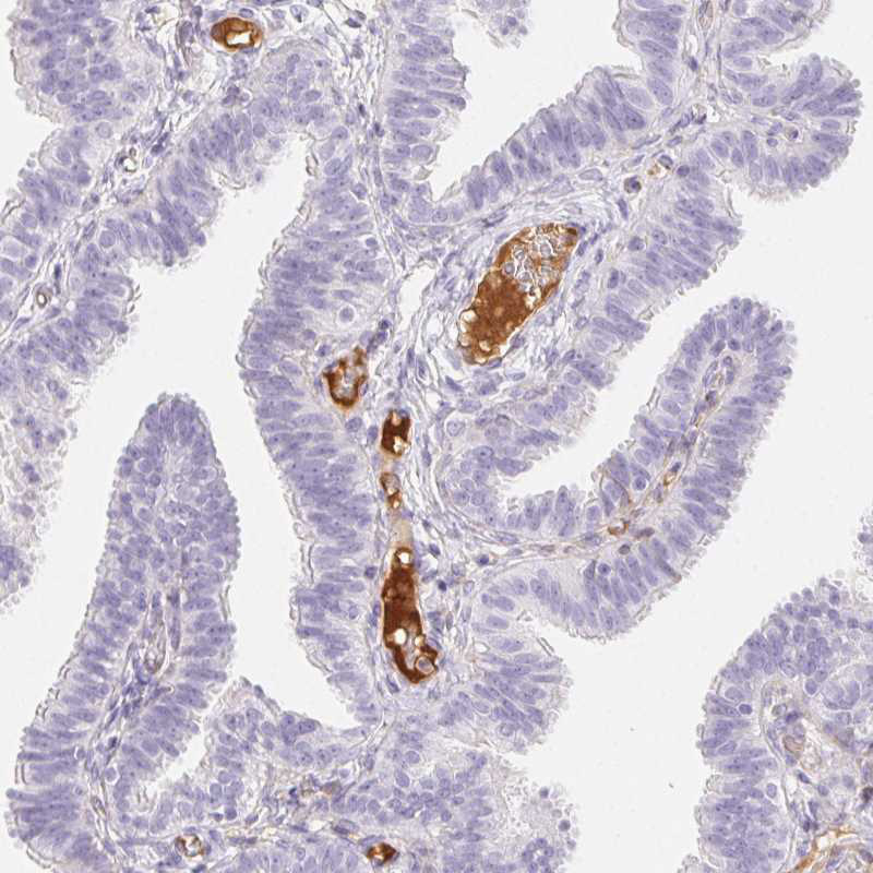 Immunohistochemistry (Formalin/PFA-fixed paraffin-embedded sections) - Anti-ITIH2/SHAP antibody (AB254773)