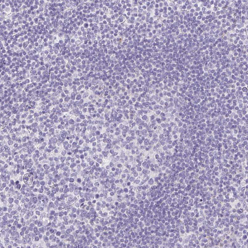 Immunohistochemistry (Formalin/PFA-fixed paraffin-embedded sections) - Anti-ITIH2/SHAP antibody (AB254773)