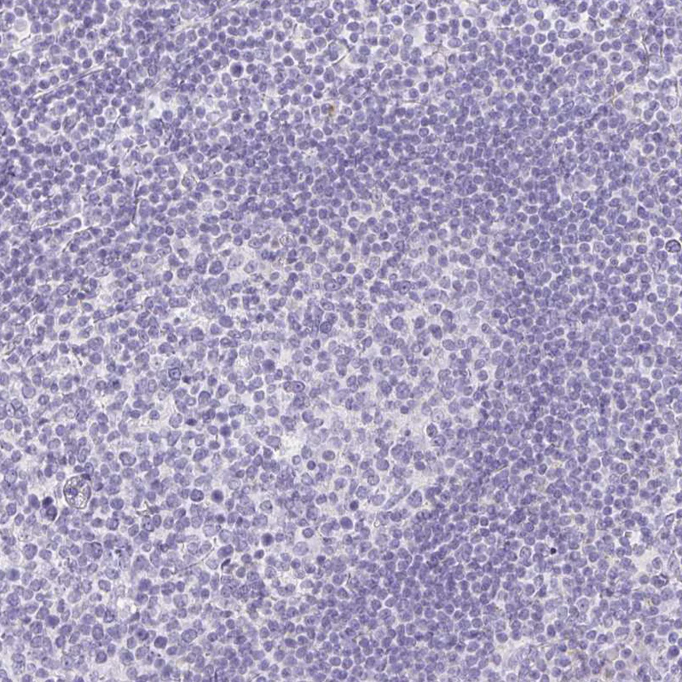 Immunohistochemistry (Formalin/PFA-fixed paraffin-embedded sections) - Anti-ITIH2/SHAP antibody (AB254773)
