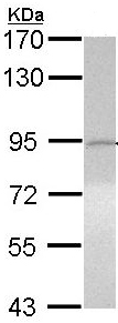 Western blot - Anti-ITIH3 antibody (AB97758), expandable thumbnail