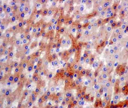 Immunohistochemistry (Formalin/PFA-fixed paraffin-embedded sections) - Anti-ITIH4 antibody [EPR11233(2)] (AB180139)