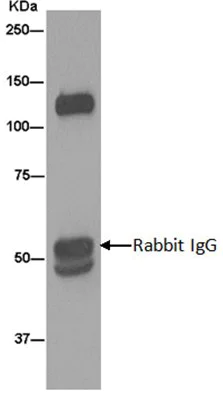 Immunoprecipitation - Anti-ITIH4 antibody [EPR11233(2)] - BSA and Azide free (AB240221)