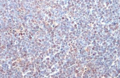 Immunohistochemistry paraffin embedded sections - Anti-ITK antibody [HL1264] (AB308352), expandable thumbnail