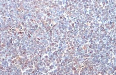 Immunohistochemistry paraffin embedded sections - Anti-ITK antibody [HL1264] (AB308352)