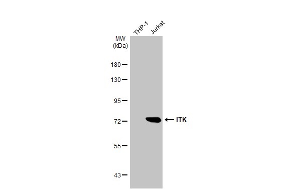 Western blot - Anti-ITK antibody [HL1264] (AB308352), expandable thumbnail