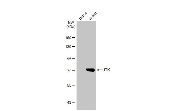 Western blot - Anti-ITK antibody [HL1264] (AB308352)