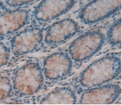 Immunohistochemistry (Formalin/PFA-fixed paraffin-embedded sections) - Anti-ITLN1 antibody (AB232885), expandable thumbnail