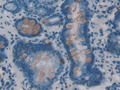 Immunohistochemistry (Formalin/PFA-fixed paraffin-embedded sections) - Anti-ITLN1 antibody (AB232885), expandable thumbnail