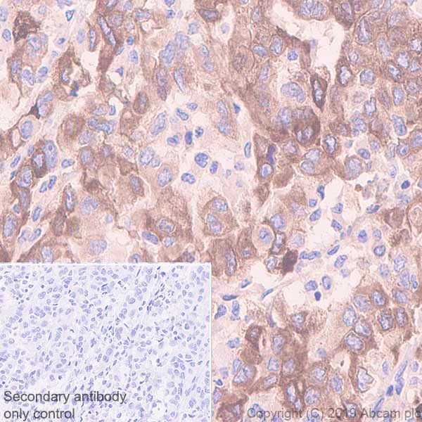 Immunohistochemistry (Formalin/PFA-fixed paraffin-embedded sections) - Anti-ITLN1 antibody [EPR22488-27] - BSA and Azide free (AB254469)