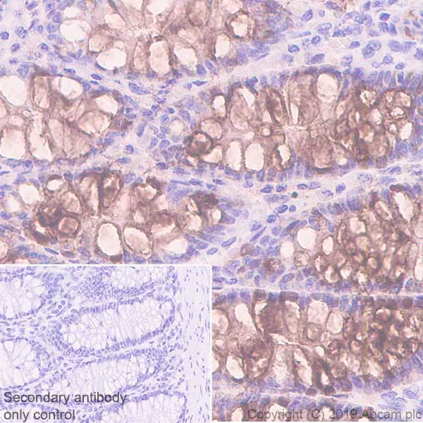Immunohistochemistry (Formalin/PFA-fixed paraffin-embedded sections) - Anti-ITLN1 antibody [EPR22488-27] - BSA and Azide free (AB254469)