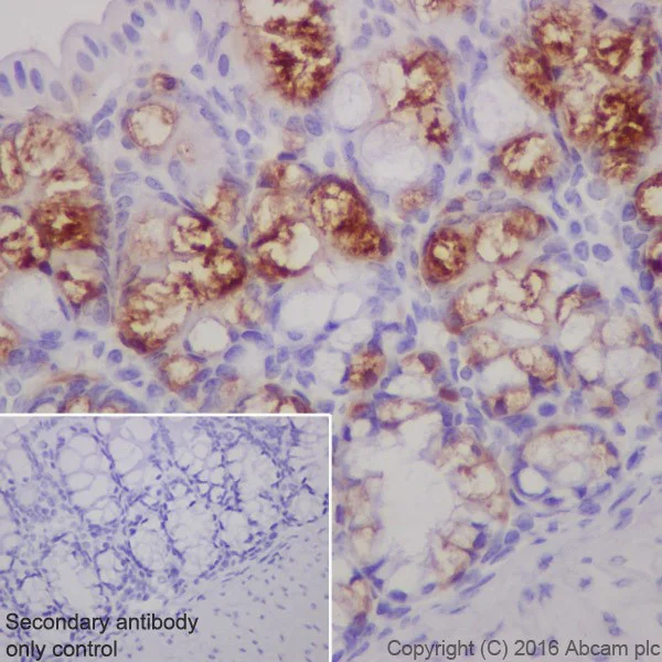 Immunohistochemistry (Formalin/PFA-fixed paraffin-embedded sections) - Anti-ITLN1 + ITLN2 antibody [EPR20311] (AB210483)