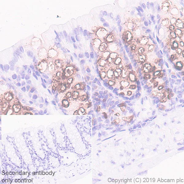 Immunohistochemistry (Formalin/PFA-fixed paraffin-embedded sections) - Anti-ITLN1 + ITLN2 antibody [EPR22491-81] (AB252926)