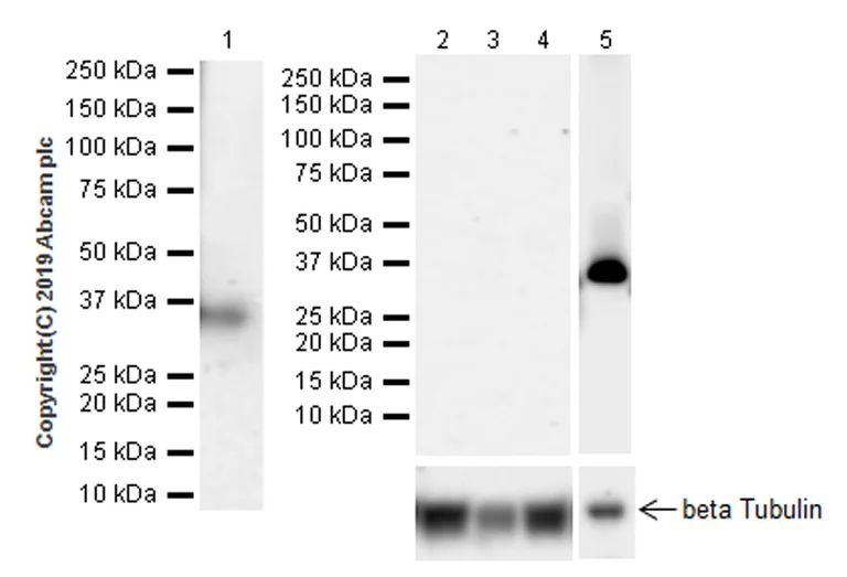 Western blot - Anti-ITLN1 + ITLN2 antibody [EPR22491-81] (AB252926)