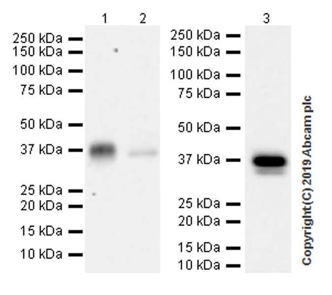 Western blot - Anti-ITLN1 + ITLN2 antibody [EPR22491-81] (AB252926)