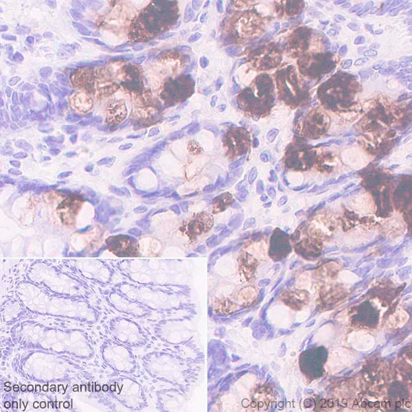 Immunohistochemistry (Formalin/PFA-fixed paraffin-embedded sections) - Anti-ITLN1 + ITLN2 antibody [EPR22491-81] - BSA and Azide free (AB254470)