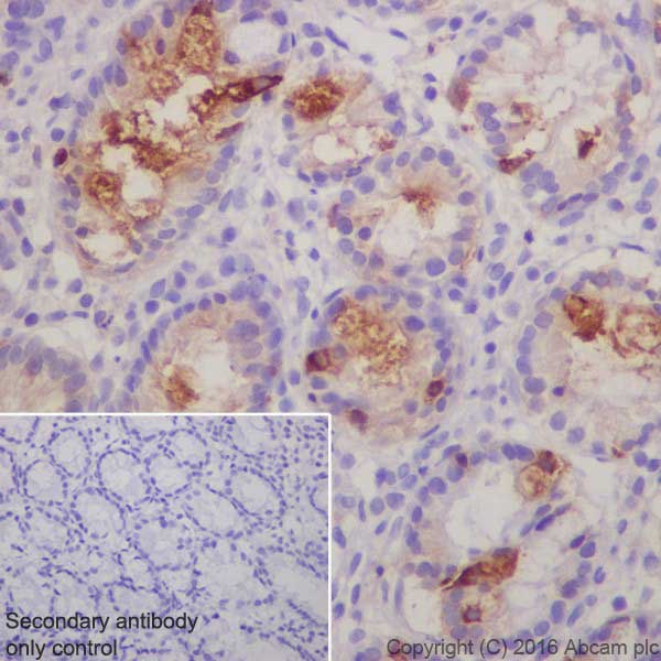 Immunohistochemistry (Formalin/PFA-fixed paraffin-embedded sections) - Anti-ITLN1+ITLN2 antibody [EPR20311] - BSA and Azide free (AB251518), expandable thumbnail