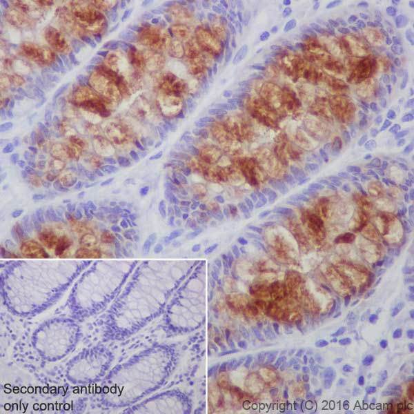 Immunohistochemistry (Formalin/PFA-fixed paraffin-embedded sections) - Anti-ITLN1+ITLN2 antibody [EPR20311] - BSA and Azide free (AB251518), expandable thumbnail
