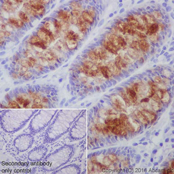 Immunohistochemistry (Formalin/PFA-fixed paraffin-embedded sections) - Anti-ITLN1+ITLN2 antibody [EPR20311] - BSA and Azide free (AB251518)