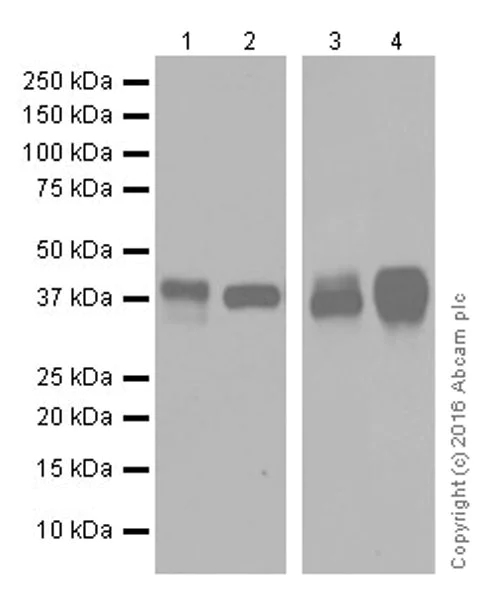 Western blot - Anti-ITLN1+ITLN2 antibody [EPR20311] - BSA and Azide free (AB251518)