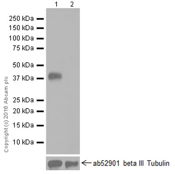 Western blot - Anti-ITLN1+ITLN2 antibody [EPR20311] - BSA and Azide free (AB251518)